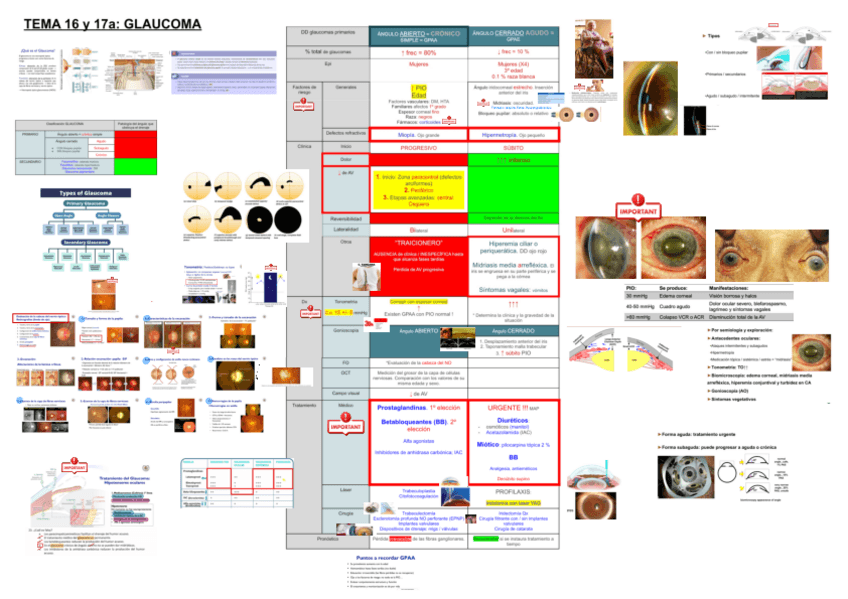 Miniatura del documento RESUMEN-GLAUCOMA.pdf