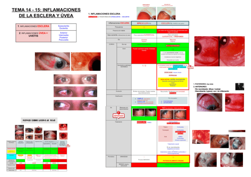Miniatura del documento 14-y-15.-ESCLERITIS-Y-UVEITIS.pdf