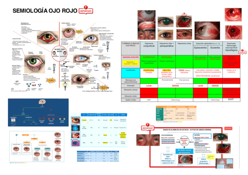 Miniatura del documento RESUMEN-SEMIOLOGIA-OJO-ROJO.pdf