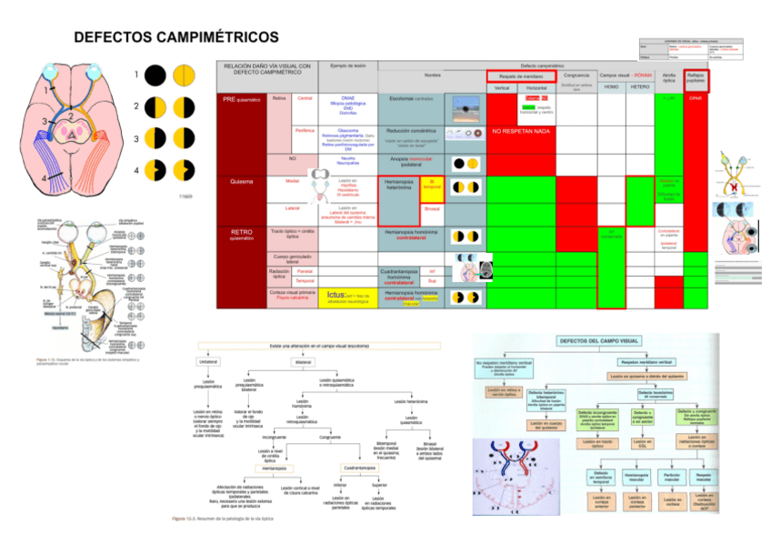 Miniatura del documento RESUMEN-DEFECTOS-CAMPIMETRICOS.pdf