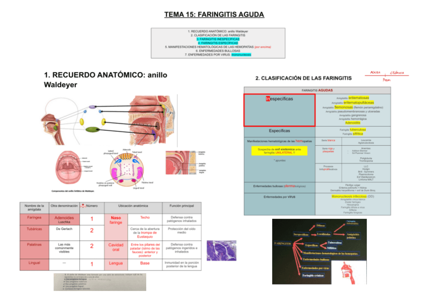 Miniatura del documento 15-FARINGITIS-AGUDA.pdf