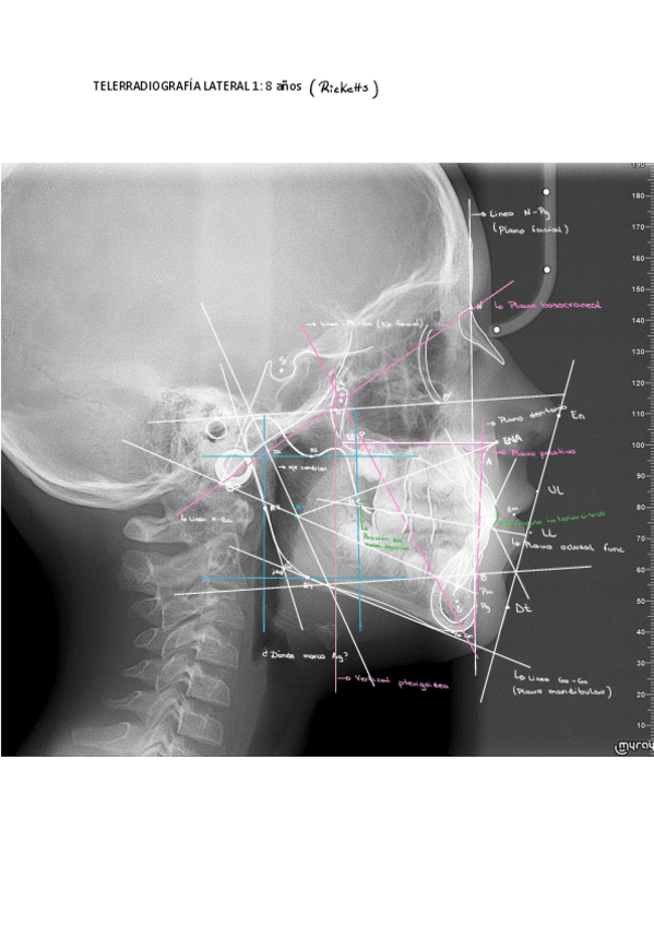 Miniatura del documento Ejemplo-Telerradiografias-Laterales-Hechas-.pdf