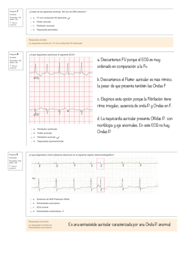 Miniatura del documento ECG.pdf
