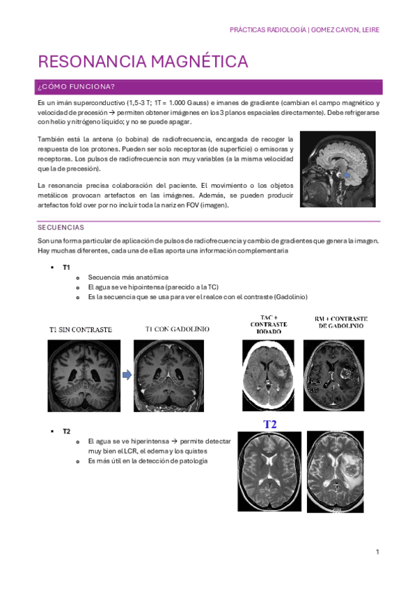 Miniatura del documento RESONANCIA-MAGNETICA.pdf