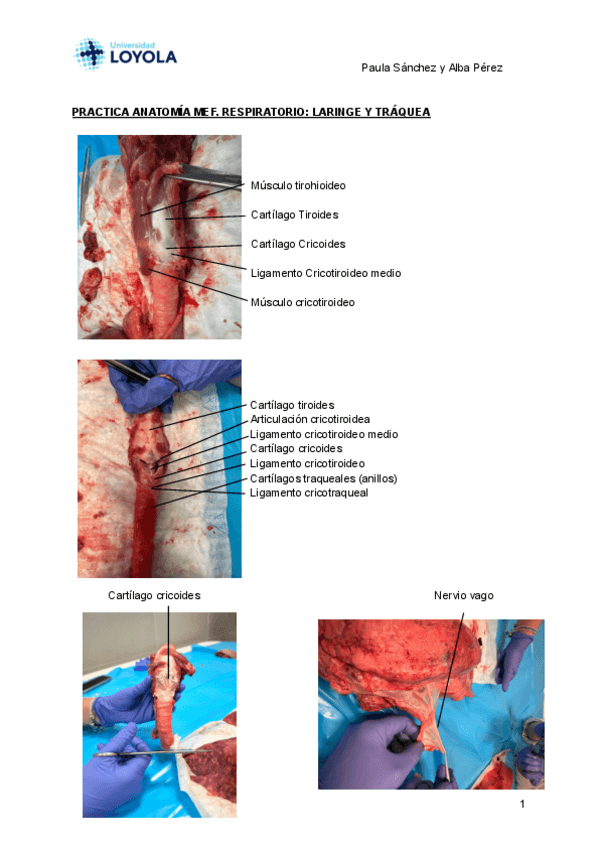 Miniatura del documento Practica-respiratorio.pdf