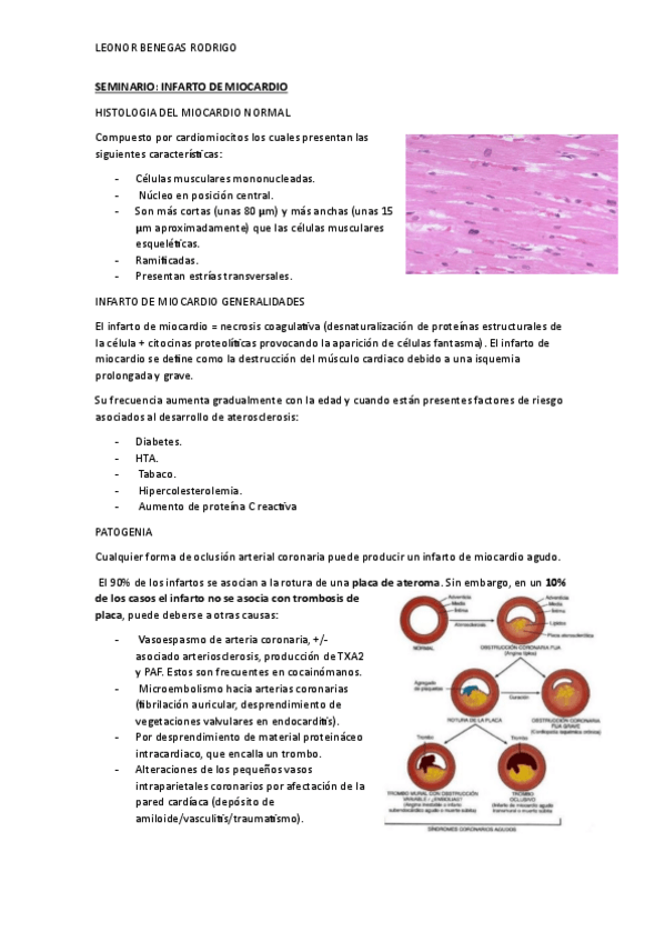 Miniatura del documento Infarto-de-miocardio.pdf