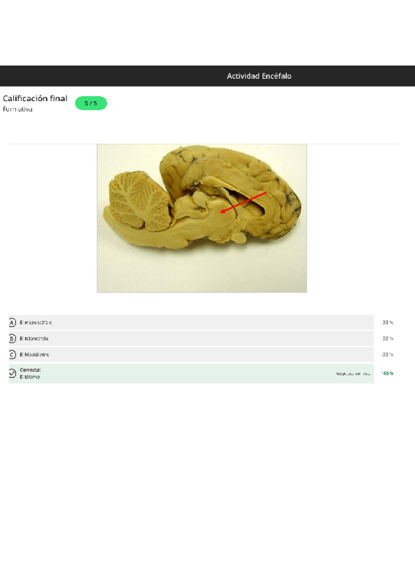 Miniatura del documento Actividad encéfalo test.pdf
