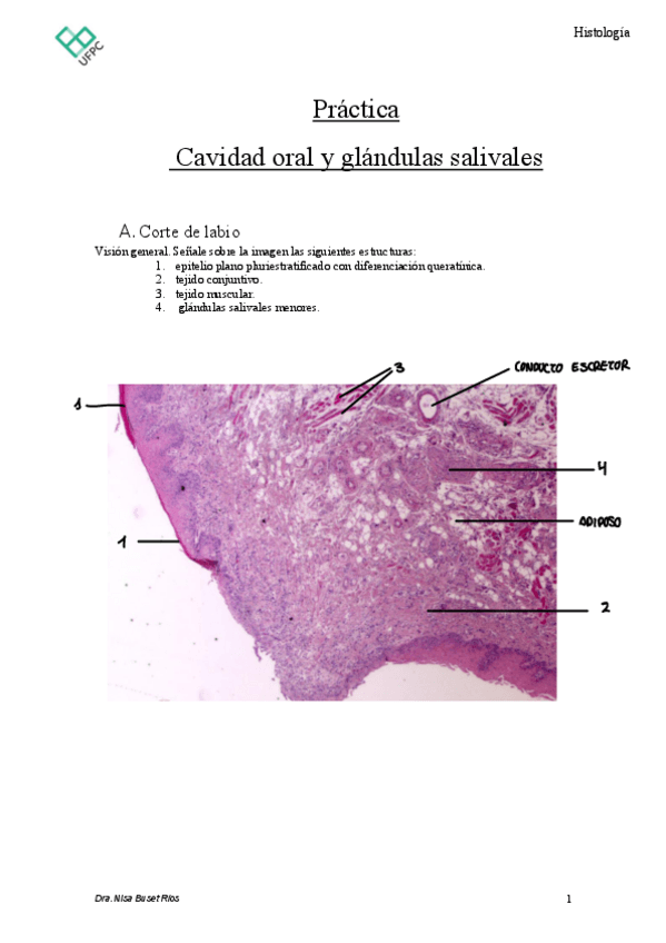 Miniatura del documento Práctica Resuelta Cavidad oral Glandulas salivales.pdf
