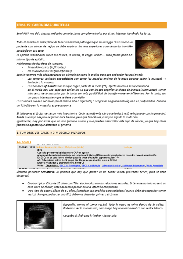 Miniatura del documento TEMA-15CARCINOMA-UROTELIAL.pdf