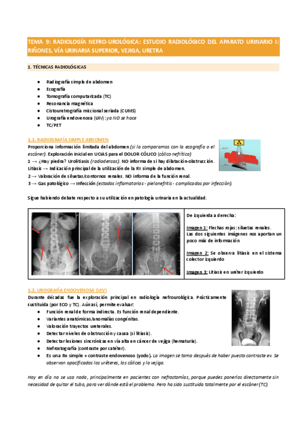 Miniatura del documento TEMA-9RADIOLOGIA-NEFRO-UROLOGICA-ESTUDIO-RADIOLOGICO-DEL-APARATO-URINARIO-I.pdf