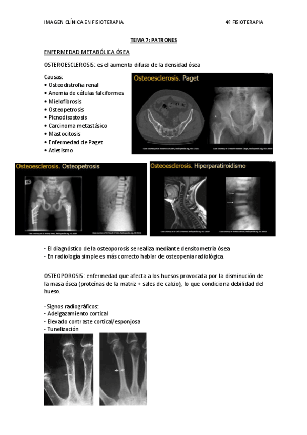 Miniatura del documento TEMA 7. Patrones.pdf