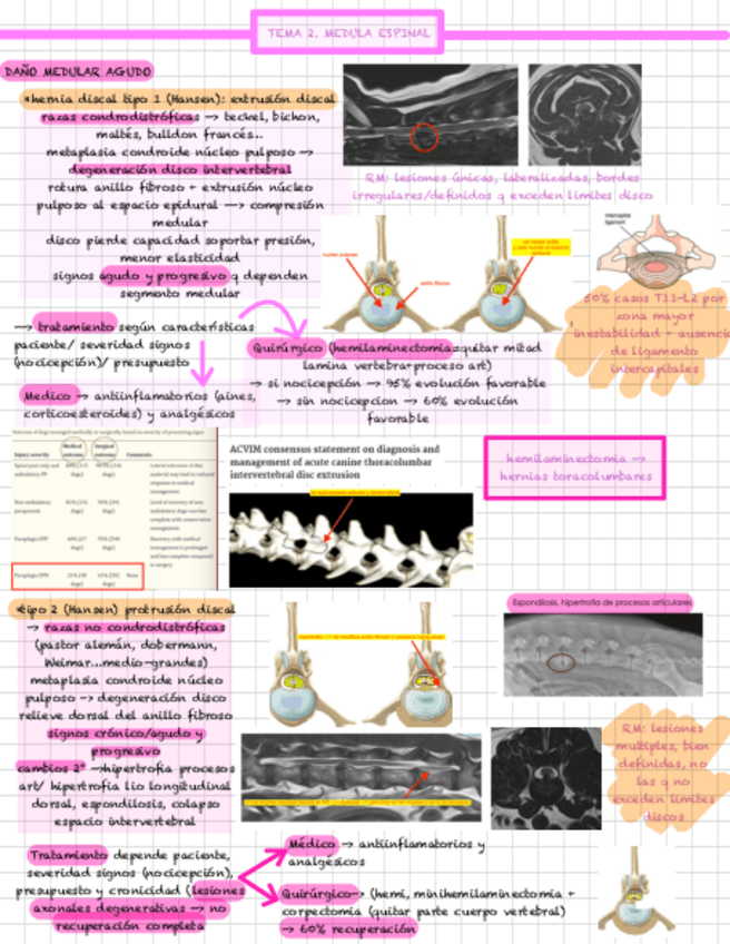 Miniatura del documento 2.-MEDULA-ESPINAL.pdf