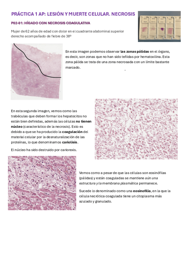 Miniatura del documento PRACTICA-1-AP.pdf