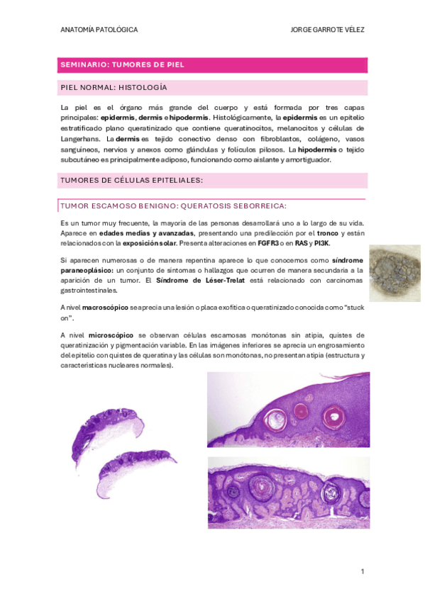 Miniatura del documento Tumores-de-Piel.pdf