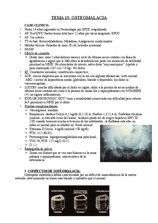 Miniatura del documento TEMA 13 Y 14 OSTEOMALACIA Y ENFERMEDAD DE PAGET.pdf