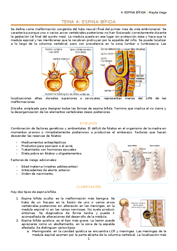 Miniatura del documento 4. Espina bífida.docx