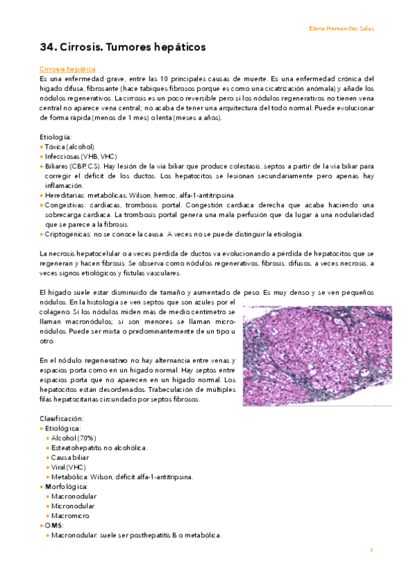 Miniatura del documento 34. Cirrosis. Tumores hepáticos.pdf