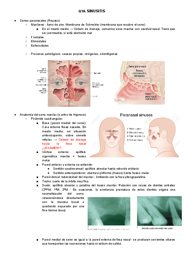 Miniatura del documento Q18. Sinusitis. 2018.2019.pdf