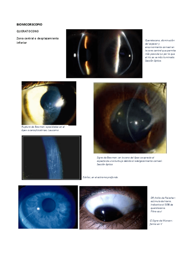 Miniatura del documento IMÁGENES LENTES II.pdf