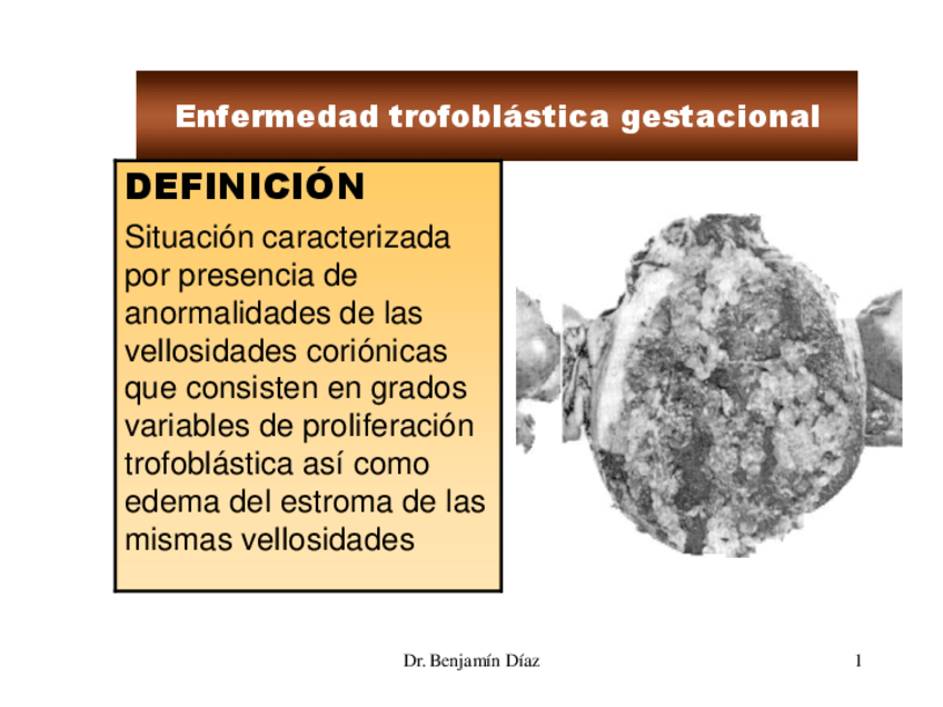 Miniatura del documento Enfermedad trofobástica gestacional.pdf