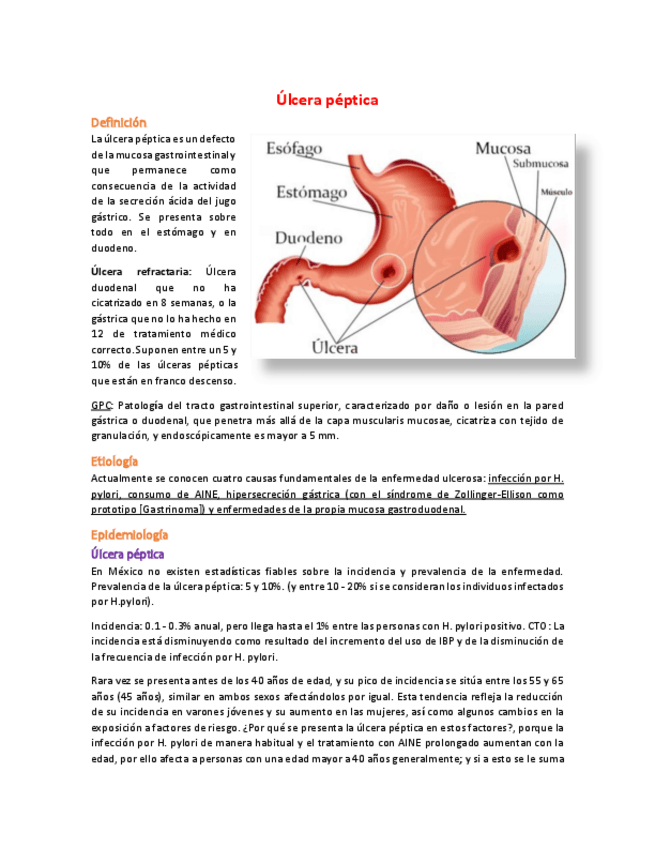 Miniatura del documento 23 Úlcera péptica.pdf