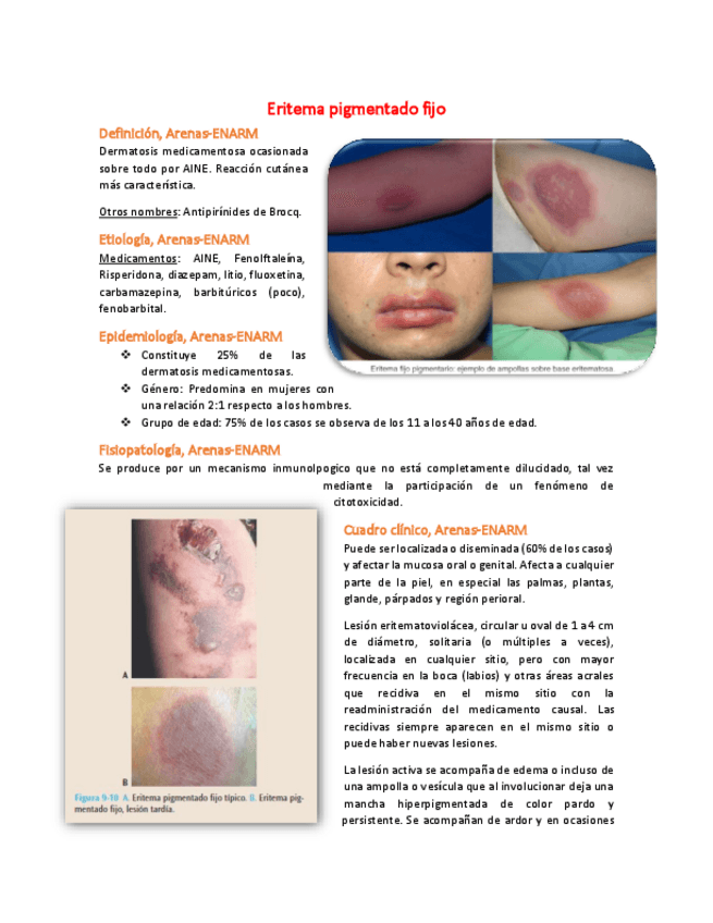 Miniatura del documento 3-Eritema-pigmentado-fijo.pdf