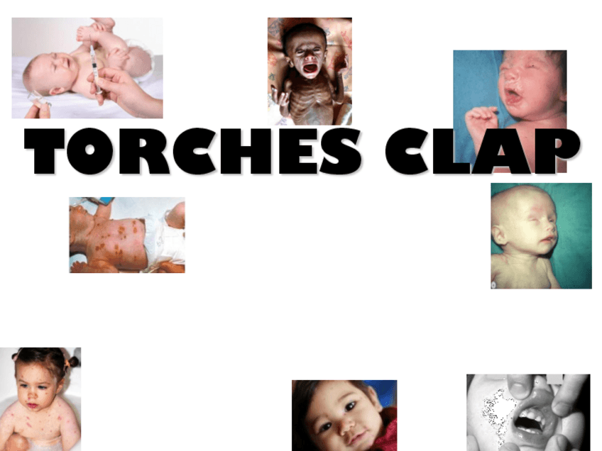 Miniatura del documento 10.-TORCHES-CLAP.pdf
