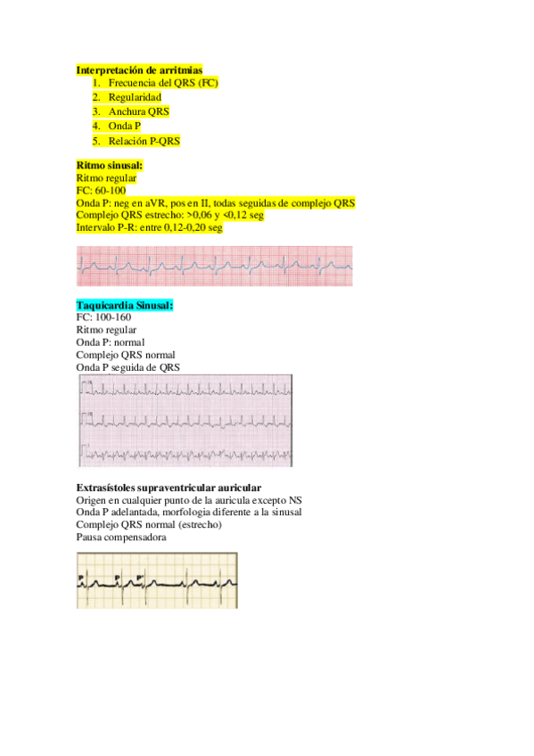 Miniatura del documento Interpretacion-de-arritmias.pdf