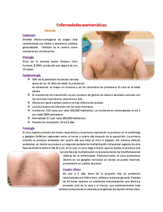 Miniatura del documento 25-Enfermedades-exantematicas-resumen.pdf