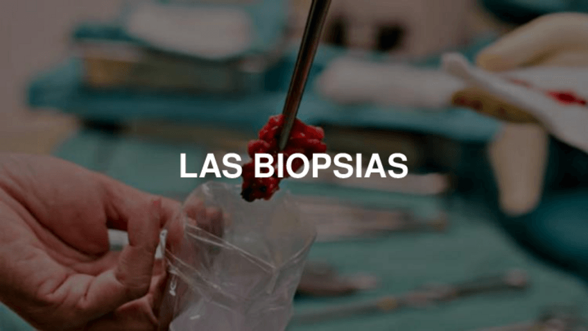 Miniatura del documento BIOPSIA.pdf