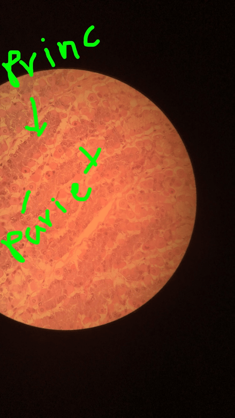 Miniatura del documento celulas-principales-y-parietales-estomago-glandular.jpg