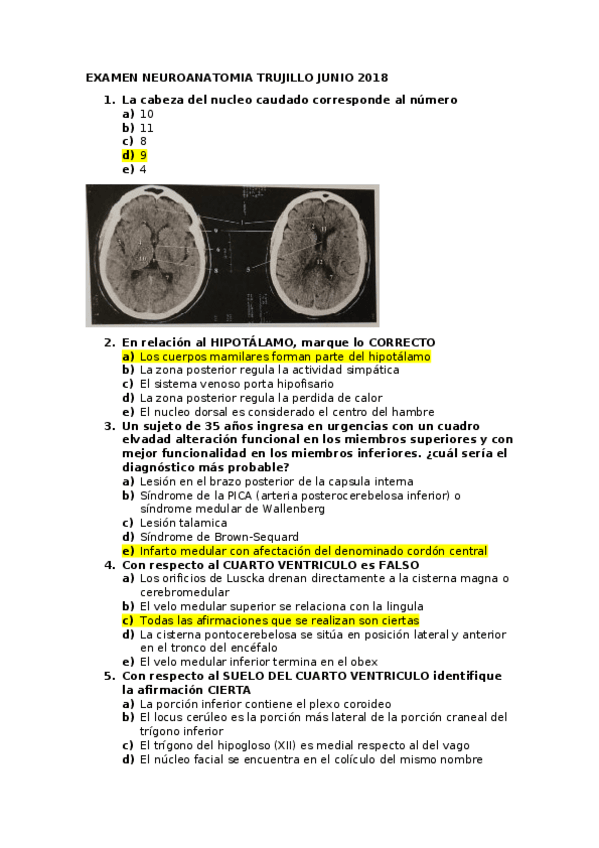 Miniatura del documento EXAMEN-JUNIO-NEURO-2018-SIN-CORREGIR.docx