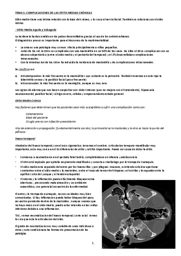 Miniatura del documento ORL 5-- Complicaciones de OMC. Virginia.pdf