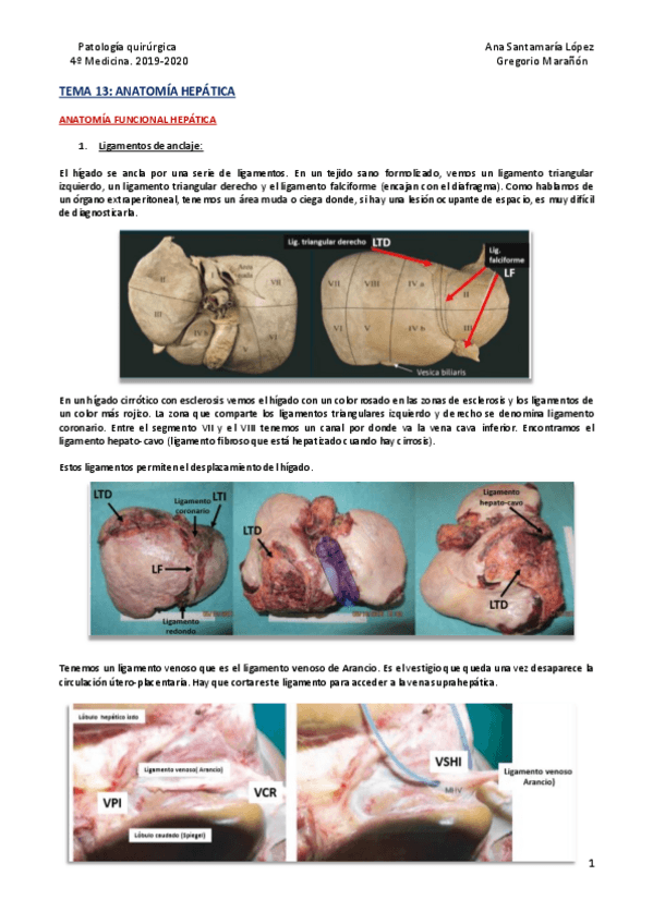 Miniatura del documento Tema-13-Anatomia-hepatica.pdf