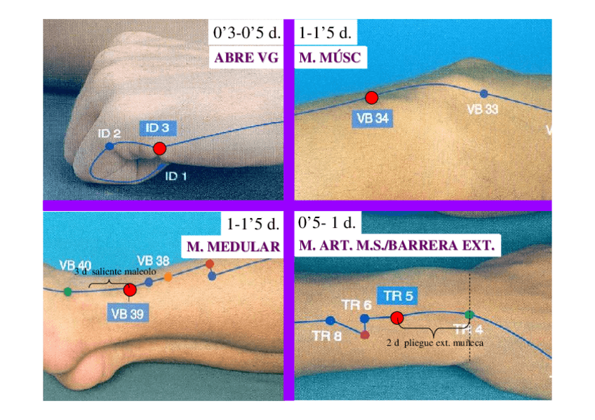 Miniatura del documento IMAGENES-PRACTICA-ACUPUNTURA.pdf