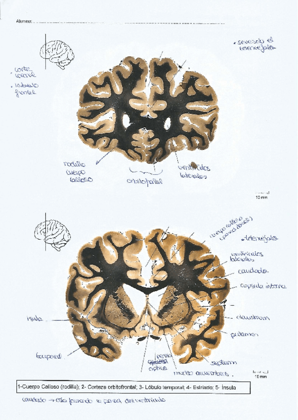 Miniatura del documento Neuroanatomia.pdf