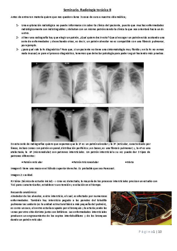 Miniatura del documento Seminario-torax-II.pdf