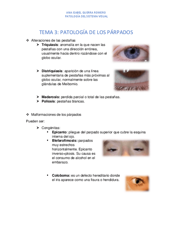 Miniatura del documento TEMA-3-Patologia-de-parpados.pdf