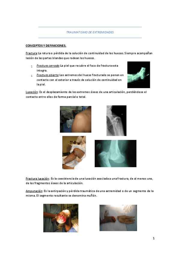 Miniatura del documento TRAUMATISMO-DE-EXTREMIDADES.pdf