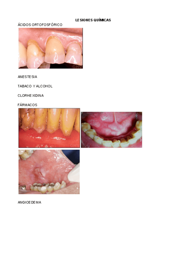 Miniatura del documento Fotos-lesiones.pdf