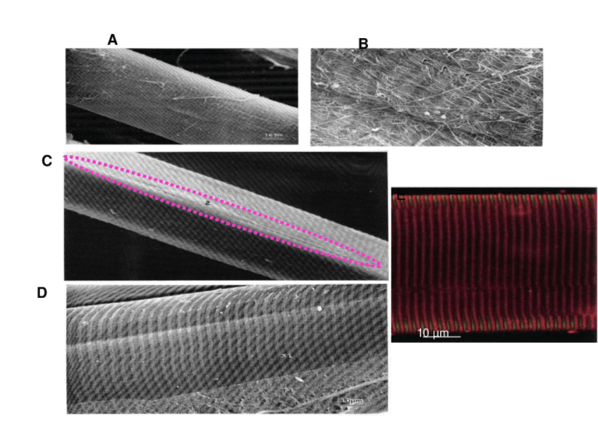 Miniatura del documento TEMA-1parteBnew-Estructuras-pasivas-del-musculo-esqueletico-cambios-con-el-ejercicio-2019-20.pdf