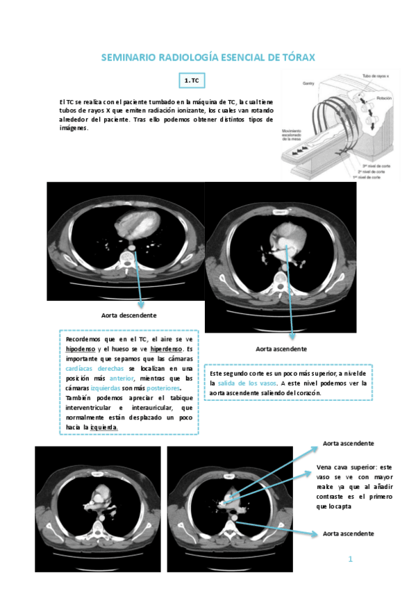 Miniatura del documento SEMINARIO-RADIOLOGIA-ESENCIAL-DE-TORAX.pdf