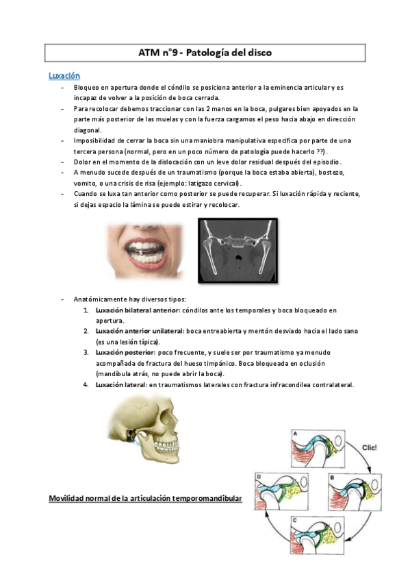 Miniatura del documento ATM-9-Patologia-del-disco--MC2016.pdf