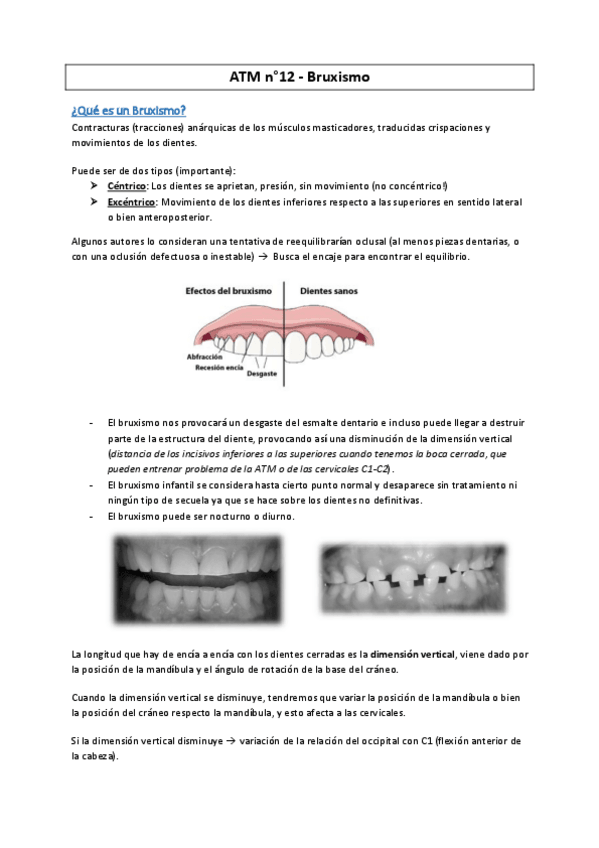 Miniatura del documento ATM-12-Bruxisme--MC2016.pdf