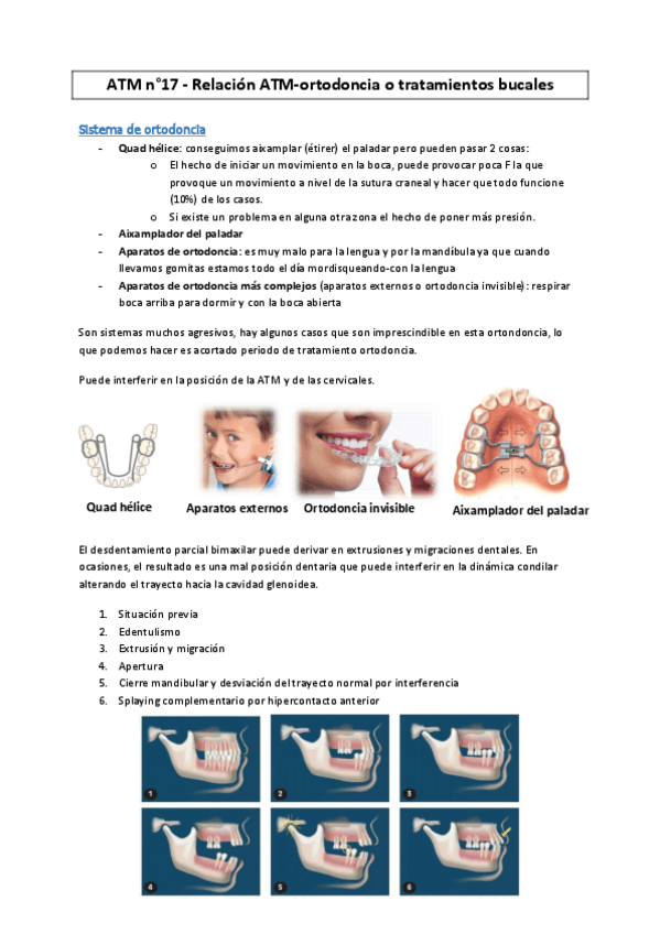 Miniatura del documento ATM-17-Relacion-ATM-Ortodoncia-o-tratamientos-bucales--MC2016.pdf