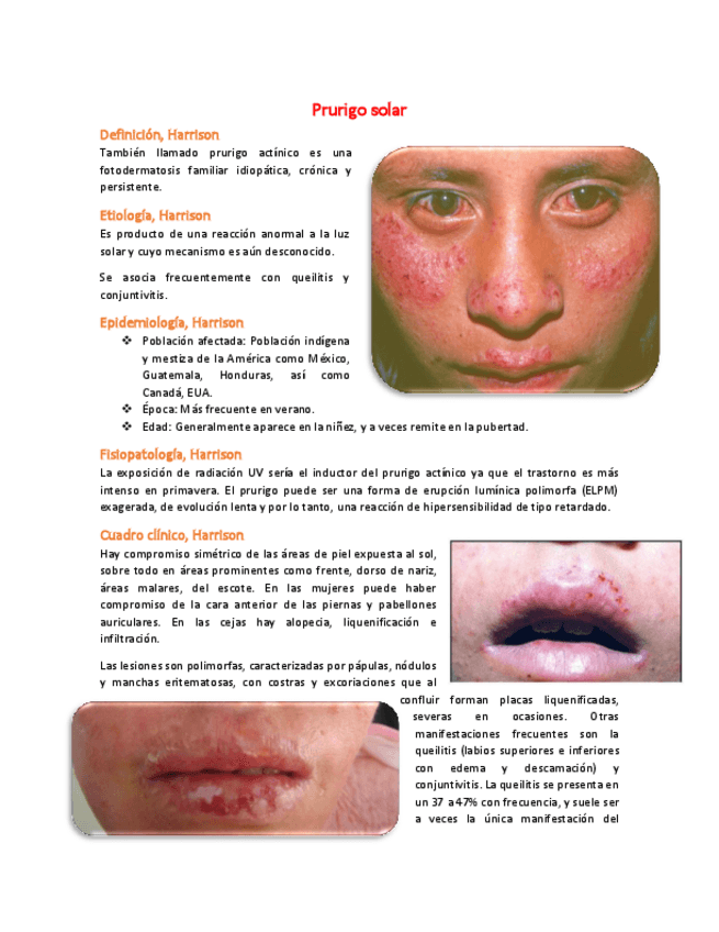 Miniatura del documento 9-Prurigo-solar.pdf