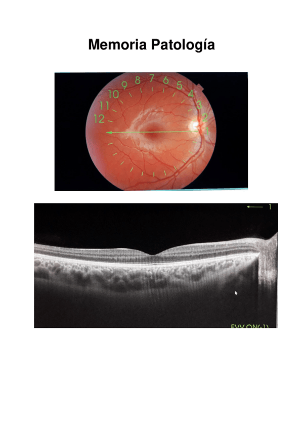 Miniatura del documento Memoria-Patologia-Wuolah.pdf
