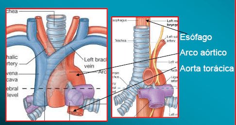 Miniatura del documento Traquea-y-arterias.png
