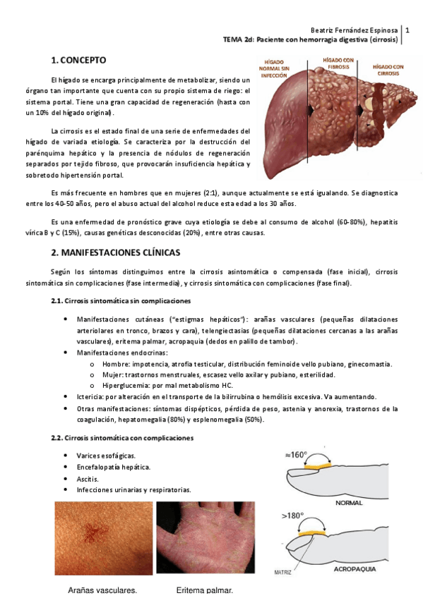 Miniatura del documento ADU2-Tema-2dHemorragia-digestiva-cirrosis.pdf