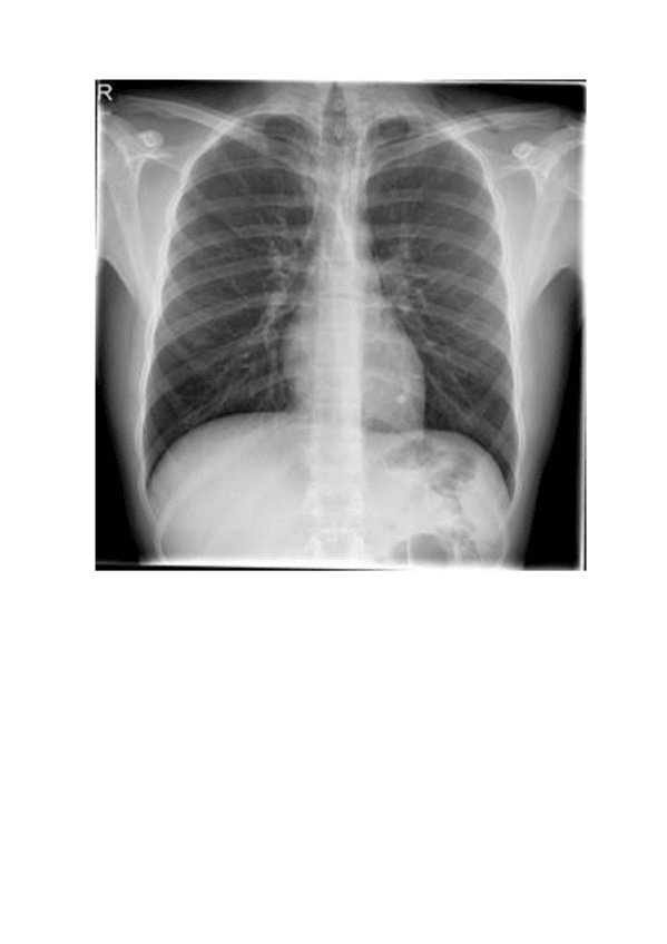 Miniatura del documento Radiografia-Torax.pdf